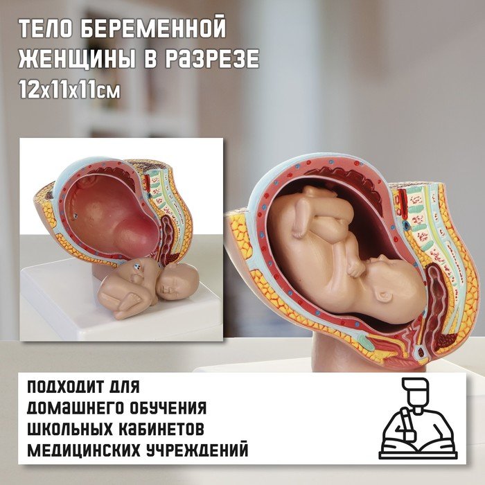 Макет "Тело беременной женщины в разрезе" 12*11*11см