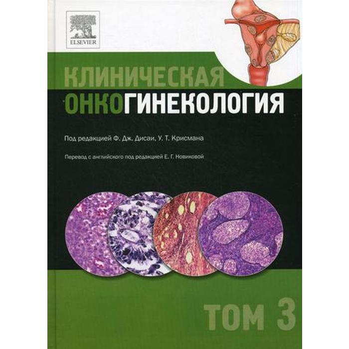 Клиническая онкогинекология. В 3 т. Т. 3. Под ред. Ф.Дж. Дисаи, У.Т. Крисмана