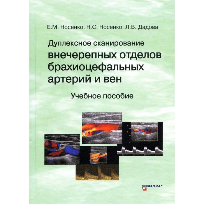 Дуплексное сканирование брахиоцефальных артерий ставрополь. Дуплексное сканирование. Дуплексное сканирование брахиоцефальных. Ультразвуковое обследование брахиоцефальных артерий. Дуплексное сканирование артерий и вен.